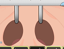 Play Nose Surgery