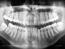 Play Operate Now - Dental Implant